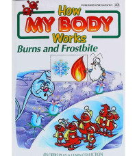 Image of How MY BODY Works : Burns and Frostbite